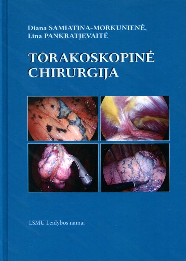 Torakoskopinė chirurgija